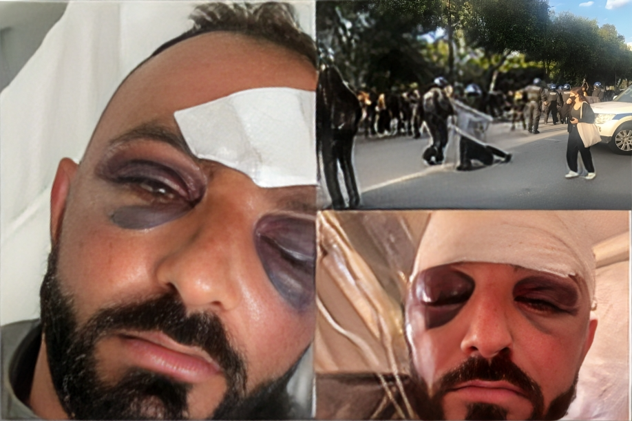 «Ήταν τρελός για αυτό και του πρεπε η δόξα» – Δεν θα ξεχαστεί ποτέ ο Κύπριος ήρωας Μιχάλης Νεοφύτου που έπεσε νεκρός στην αντίσταση κατά των lockdown και των υποχρεωτικών εμβολιασμών